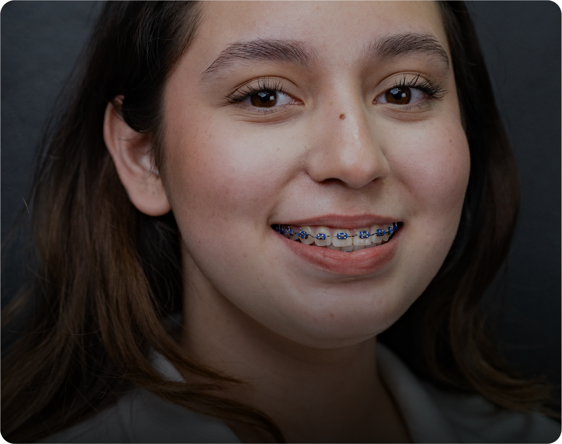 Tratamiento de armonización facial